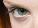 Zusammenhang zwischen gelben Augen Knötchen und Herzinfarkt-Risiko