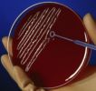 VZBV: Infektionsschutz gegen Krankenhausinfektionen verbessern